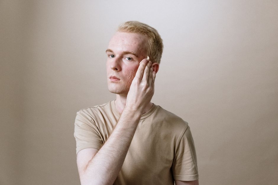 Men’s Moisturiser for Cold-Weather Skin: How to Choose and Use One